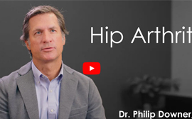 Understanding and Managing Hip Arthritis